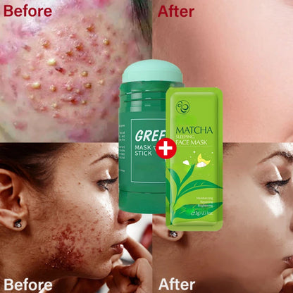 2PCS Green Tea Repair Acne Mud Mask Face Clean Clay Stick Pore Shrinkage Treat Pimple Cream Nose Blackhead Remove Oil Control