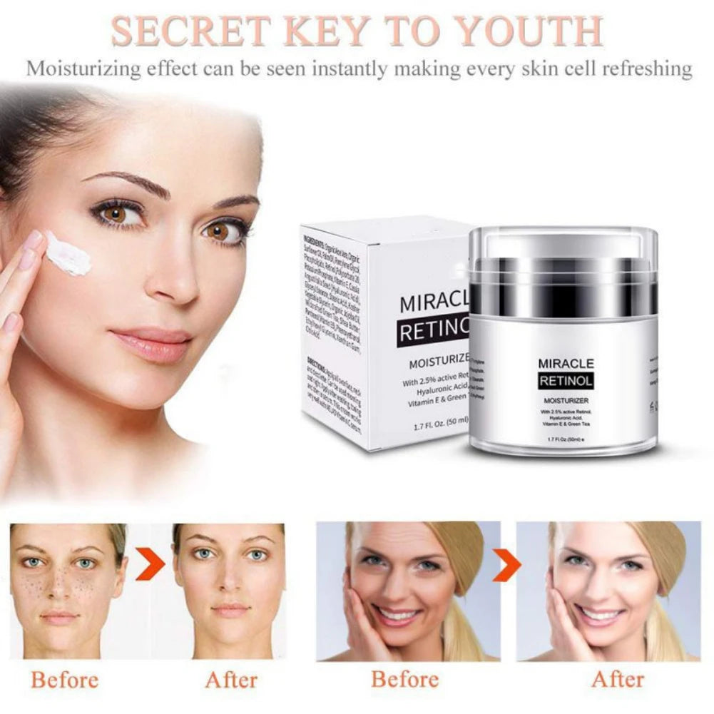 Retinol 2.5% Moisturizer Cream For Anti Aging And Reduces Wrinkles Fine Lines Skin Care Day And Night Retinol Cream