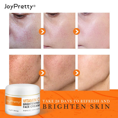 JoyPretty Vitamin C Face Whitening Cream VC Acne Pimple Mark Removal Dark Spots Facial Creams Moisturizing Cream Skin Care 50ml