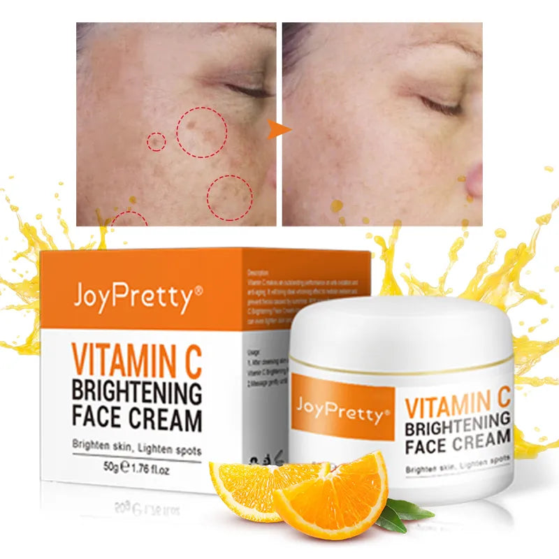 JoyPretty Vitamin C Face Whitening Cream VC Acne Pimple Mark Removal Dark Spots Facial Creams Moisturizing Cream Skin Care 50ml