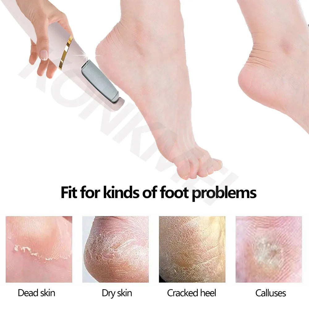 2023New Electric Foot Grinding Skin Hard Rupture Skin Trimmer Dead Skin Foot Pedicure Rechargeable Foot Care Tool Remover Callus