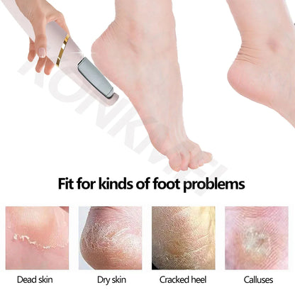 2023New Electric Foot Grinding Skin Hard Rupture Skin Trimmer Dead Skin Foot Pedicure Rechargeable Foot Care Tool Remover Callus